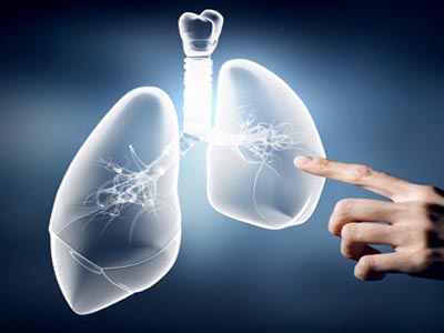 Lung Cancer Risk Factors