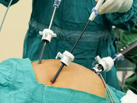 Cancer Treatment
