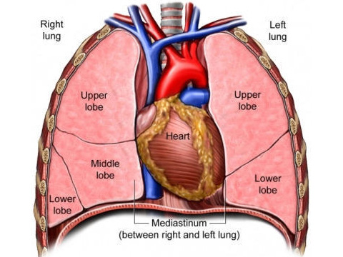 Mediastinal Tumors