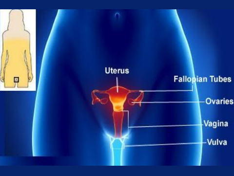 Vulvar Cancer